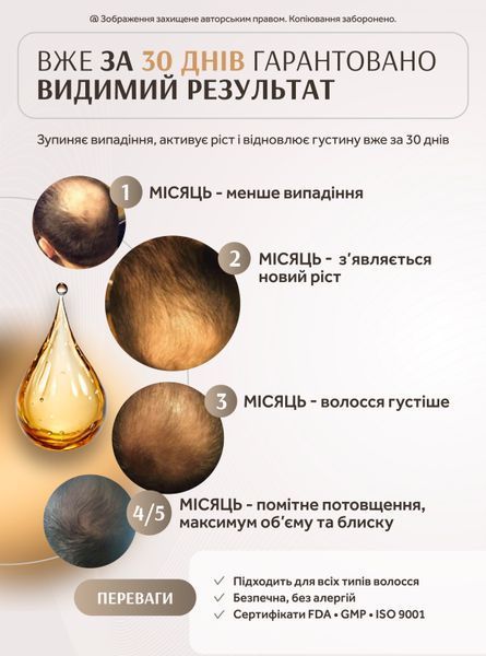 Інноваційний лосьйон для росту волосся та боротьби з його випадінням Charismo DEKOHAIR DEKOPILL 60ml 81344628 фото